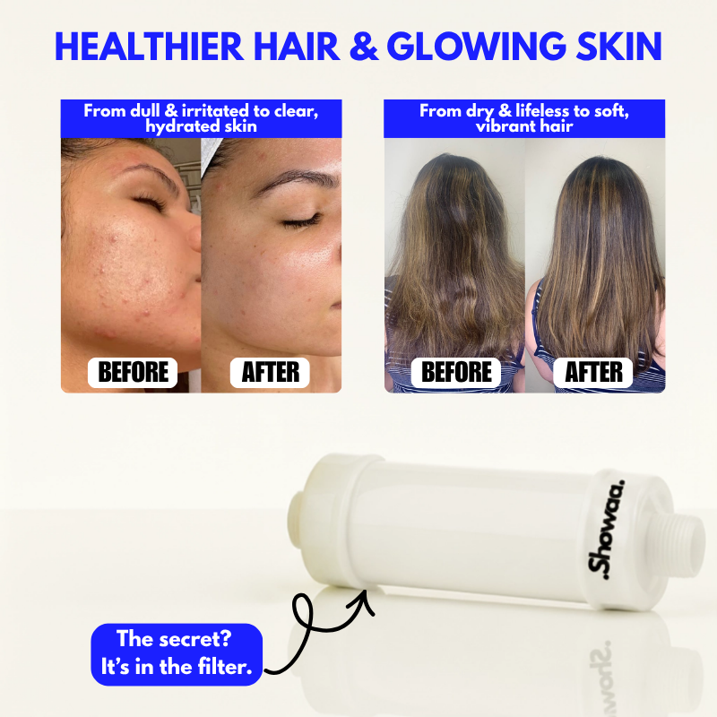 Showaa™ Vitamin Shower Filter